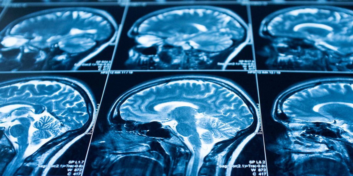 poster-facebook-NYU-fast-mri-study.jpg