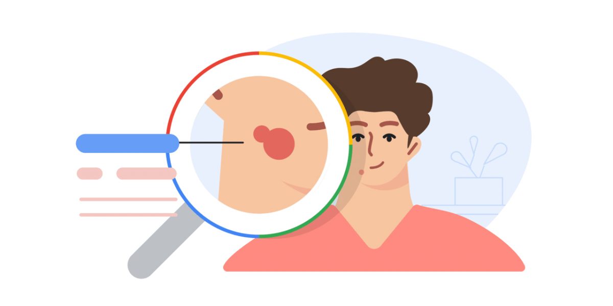 p-1-google-launches-a-new-search-feature-to-help-you-figure-out-what-that-mole-is.jpg