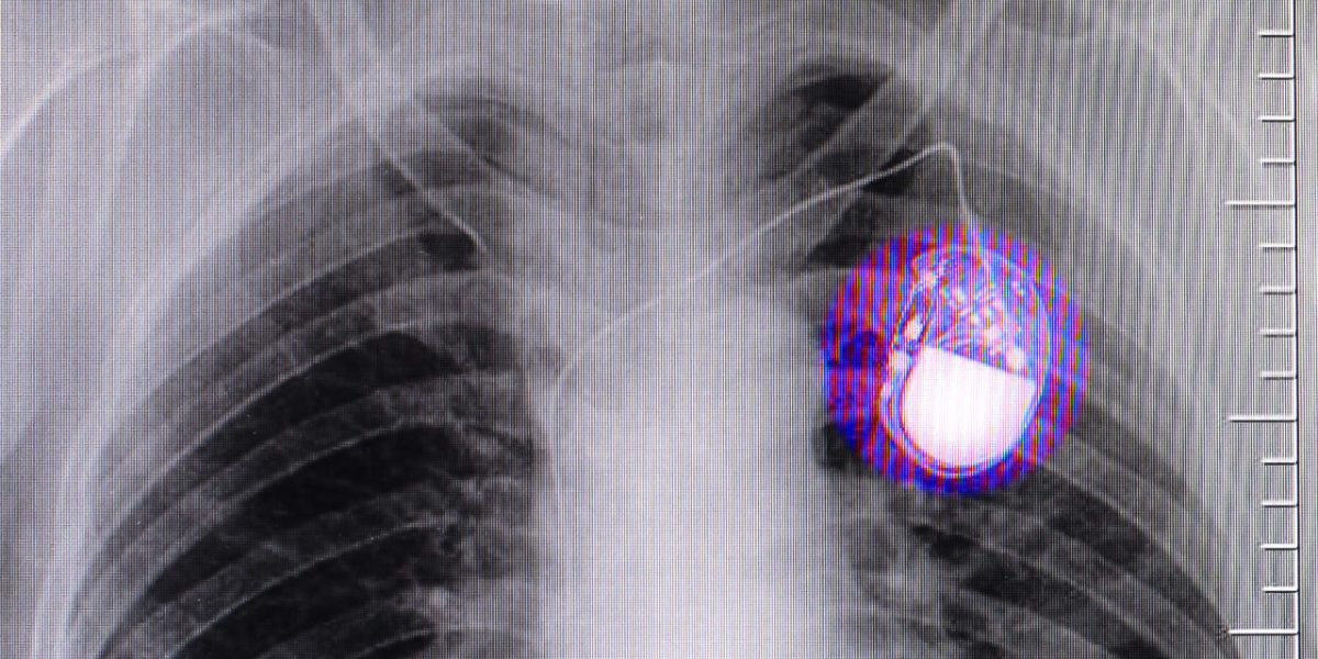 p-1-apple-magsafe-pacemakers-study.jpg